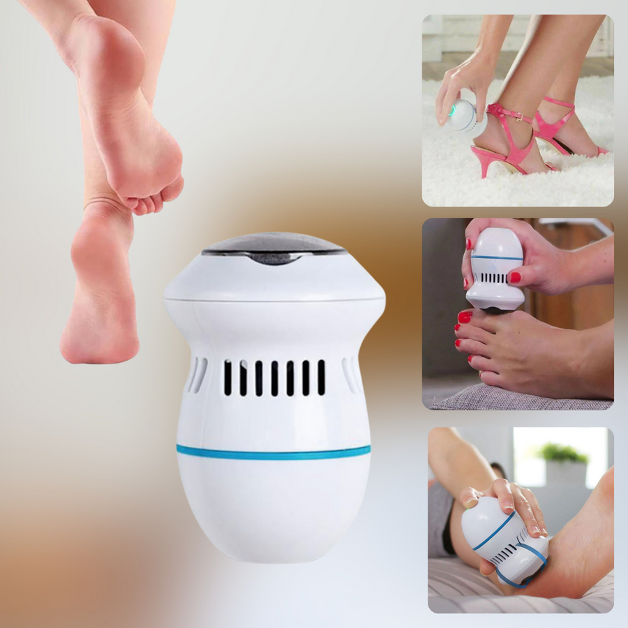 LOVELY™ | SMART CALLUS REMOVER